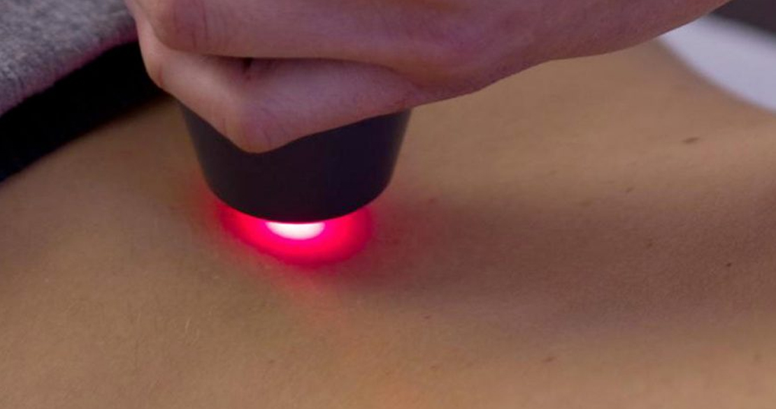 Laser terapia